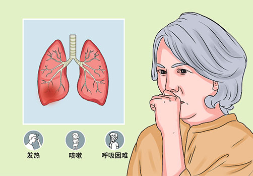 刘建博主任分享：中医视角下的肺大泡防治方法